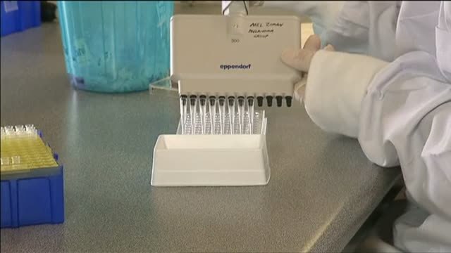 Descubren el primer análisis de sangre capaz de detectar melanomas