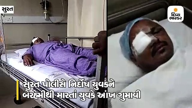 કસ્ટોડિયલ ડેથની શાહી સુકાઈ નથી ત્યાં પોલીસના મારથી યુવાને આંખ ગુમાવ્યાનો આક્ષેપ