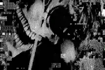 MVGEN: Melvins  : Ballad of Dwight Fry