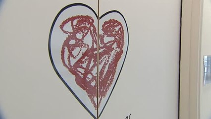 Realizan con éxito el segundo trasplante de corazón no compatible