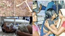 Chamki Fever में बच्चों की मौत के बाद Muzaffarpur Hospital के पीछे मिले कई नरकंकाल | वनइंडिया हिंदी