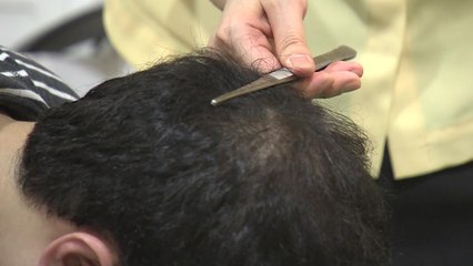 스트레스성 탈모 늘어...운동·규칙적인 수면 도움 / YTN