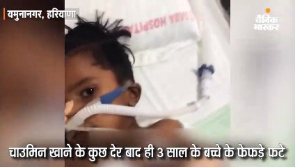 चाउमिन खाने के कुछ देर बाद 3 साल के बच्चे के फेफड़े फटे; डॉक्टर्स ने मुश्किल से बचाई जान