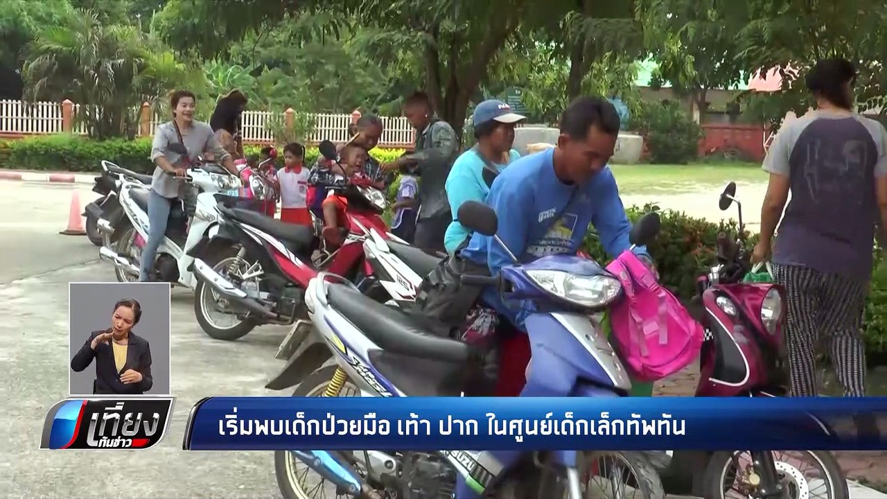 เตือน !! เด็ก เริ่มป่วยโรค มือ เท้า ปาก - เที่ย...