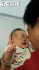 Ce bébé est né sans yeux ! Tellement triste...