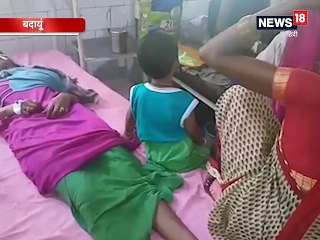 मायके जाने की जिद पर अड़ी पत्नी को पति ने पहले पीटा, फिर चबा डाली नाक