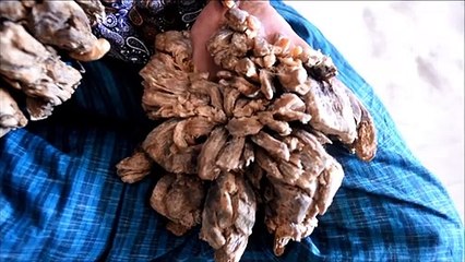 Desesperado, "hombre árbol" pide ser amputado