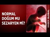 Normal Doğum mu Sezaryen mi?