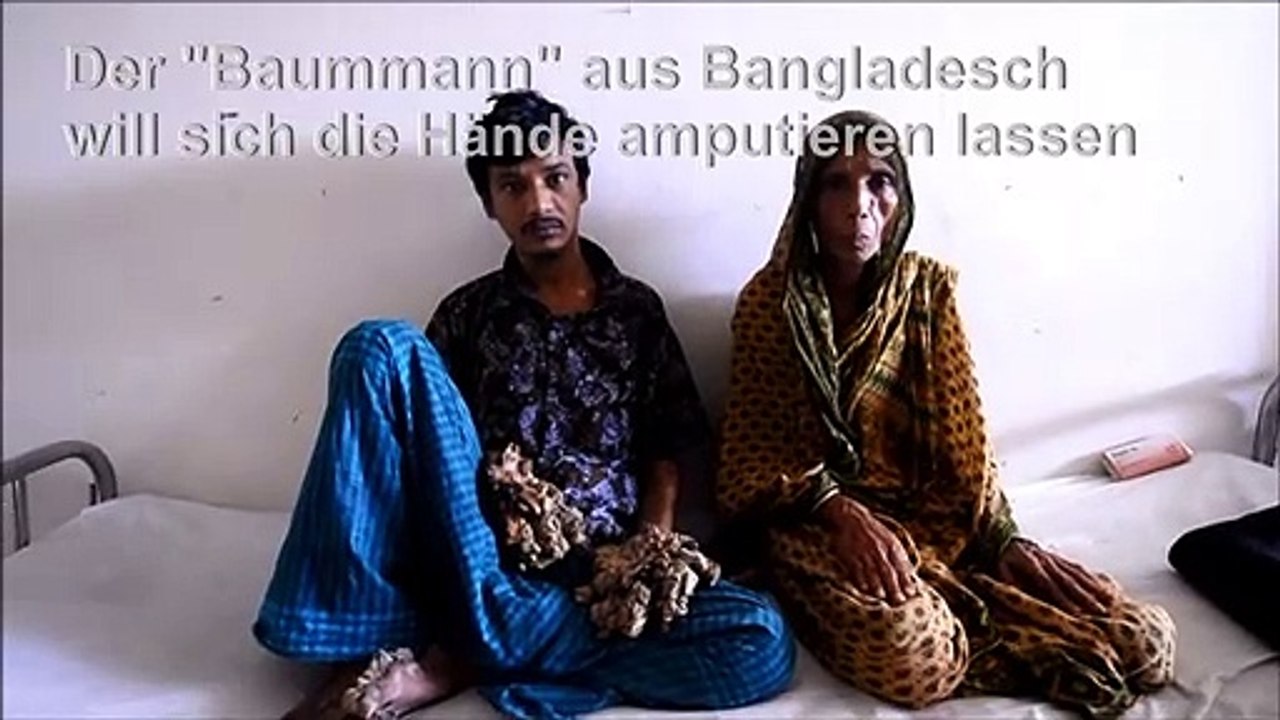 'Baummann' will sich Hände amputieren lassen