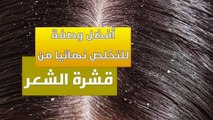 سفرة سالي مع سالي فؤاد | وصفة سحرية مش هتصدقي مكوناتها ... هتقضي على قشرة الشعر تماما!!!