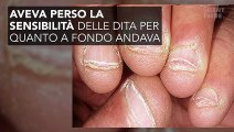 Muore perché si mangia le unghie