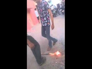 A senseless stunt with fire took this Hyderabad boy's life