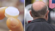 禿頭福音 科學家用3D列印長頭髮
