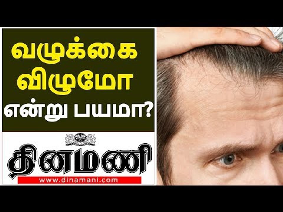 Hair fall Treatment  |  BIGGEST HAIR Fall AND BALDNESS MYTHS REVEALED