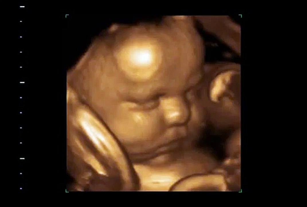 3D Ultrasound, 4D Ultrasound & HD Ultrasound Imaging Center