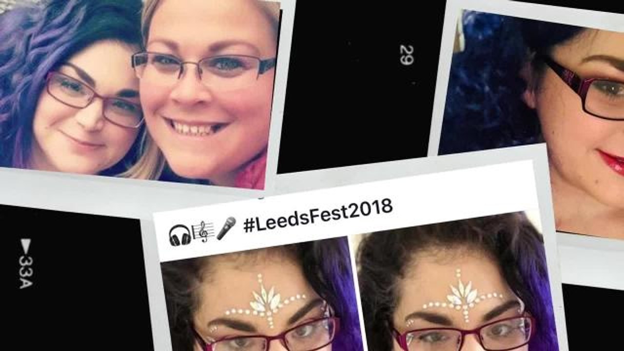 Aspiring teacher, 29, whose skull is crushing her brain stem has three weeks to raise £80,000 for surgery not available on NHS