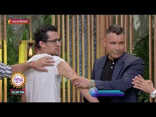 ¿Cuáles son los efectos negativos de las cicatrices? | Sale el Sol