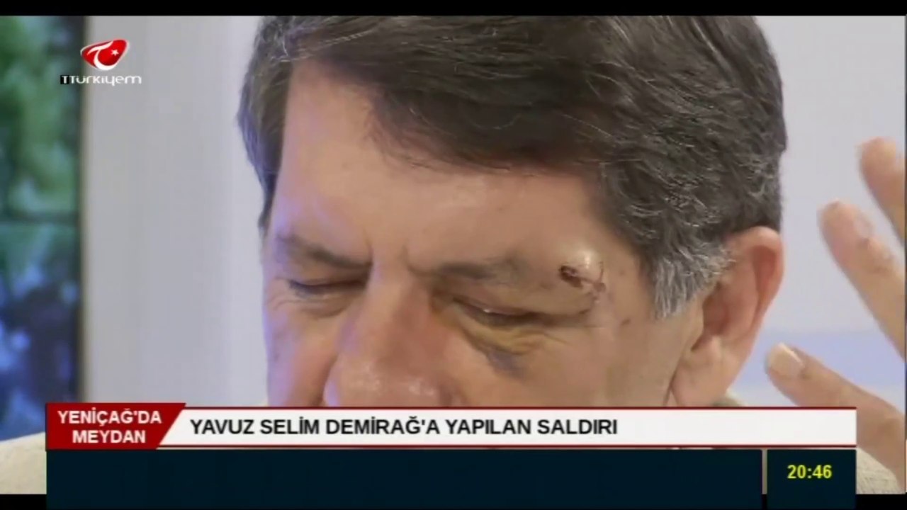 YAVUZ SELİM DEMİRAĞ KENDİSİNE YAPILAN SALDIRIYI TÜM DETAYLARIYLA ANLATTI-HULKİ CEVİZOĞLU&BAHADIRHAN DİNÇASLAN- 1. BÖLÜM
