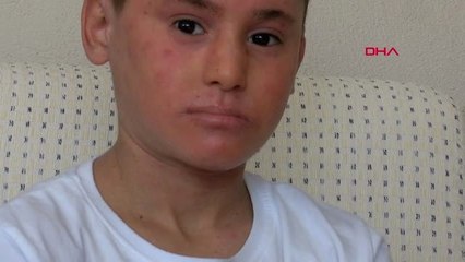 İZMİR Balık derisi hastası Kayra, yaralarının iyileşmesi için destek bekliyor