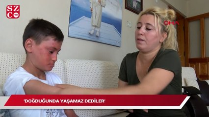 Balık derisi hastası Kayra, yaralarının iyileşmesi için destek bekliyor
