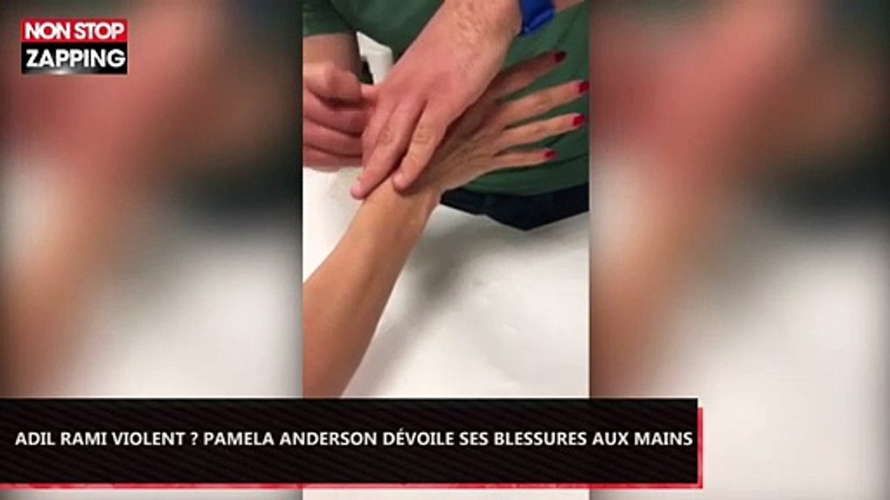Adil Rami violent ? Pamela Anderson dévoile ses blessures aux mains (Vidéo)