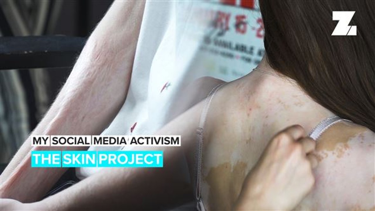 My Social Media Activism: Behind #ProjectTheSkin