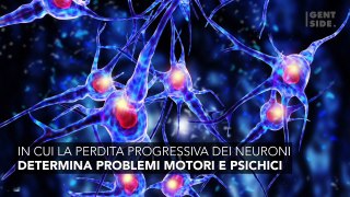 È dall’intestino che ha origine il morbo di Parkinson 3702