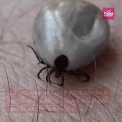 Les cas de #maladiedeLyme sont en hausse : ils passent de 69 à 104 cas pour 100 000 habitants #borreliose