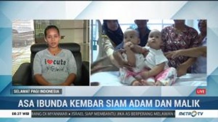 Kondisi Terkini Kembar Siam Adam dan Malik