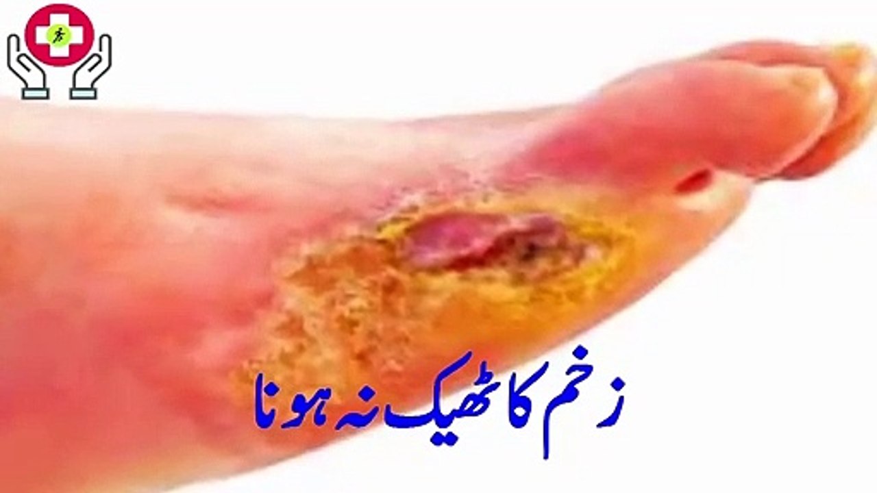 7 Foot Symptoms and Their Meaning  -- Health Tips In Urdu.