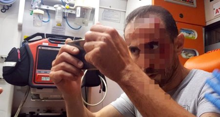 Ambulansta kanlı yüzünü çeken yaralı herkesi şoke etti!