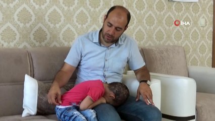 Kafa derisinde yaralar çıkmıştı, 3 yaşındaki Lorin’in tedavisine başlandı