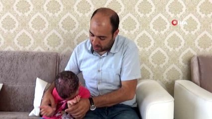 Kafa derisinde yaralar çıkmıştı, 3 yaşındaki Lorin'in tedavisine başlandı
