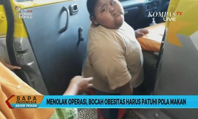 Inilah Ragam Cara Mengatasi Obesitas