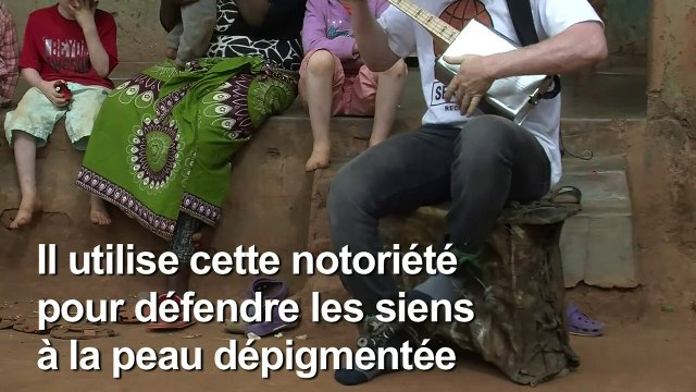 Malawi: portrait d'un musicien albinos à la renommée mondiale