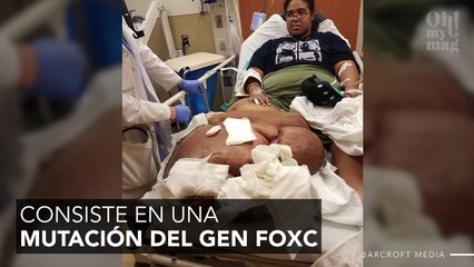 Una enfermedad rara la obligaba a estar en cama con tan solo 27 años