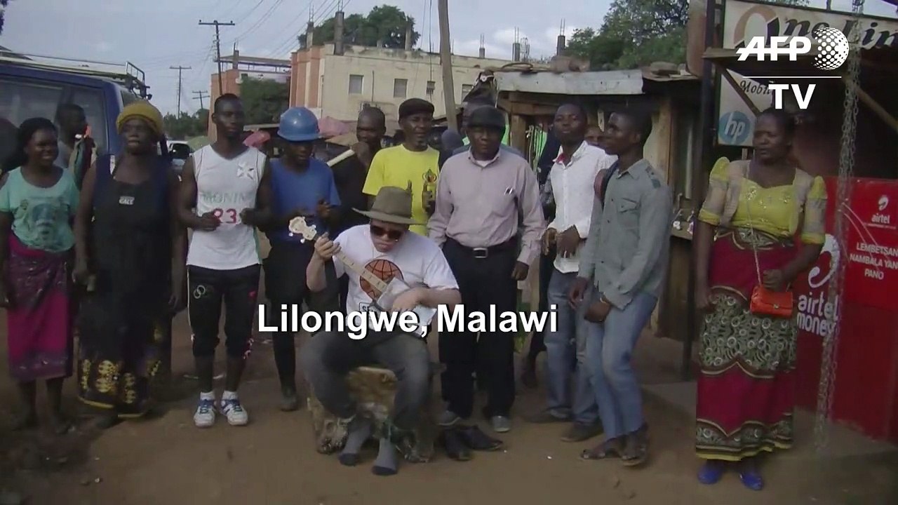 Malawi: albino busker becomes internationally acclaimed musician