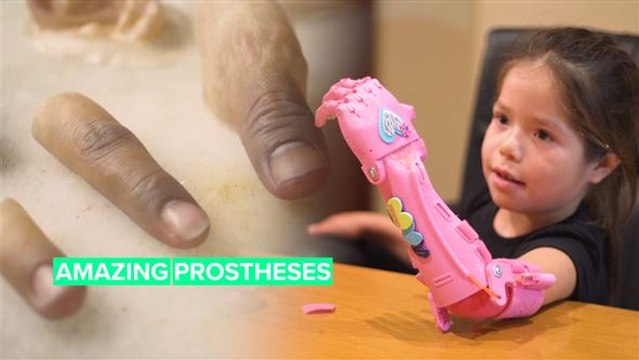 These prostheses are helping people live their best lives