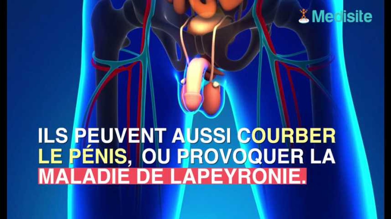 Le "jelqing" pour s'agrandir le pénis est dangereux