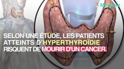 Le traitement de l'hyperthyroïdie entraîne un risque de cancer mortel