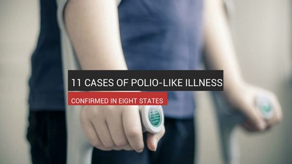 11 Cases Of Polio-Like Illness Confirmed