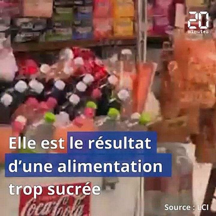 Boire une seule canette de soda par jour, c'est déjà nocif pour le foie