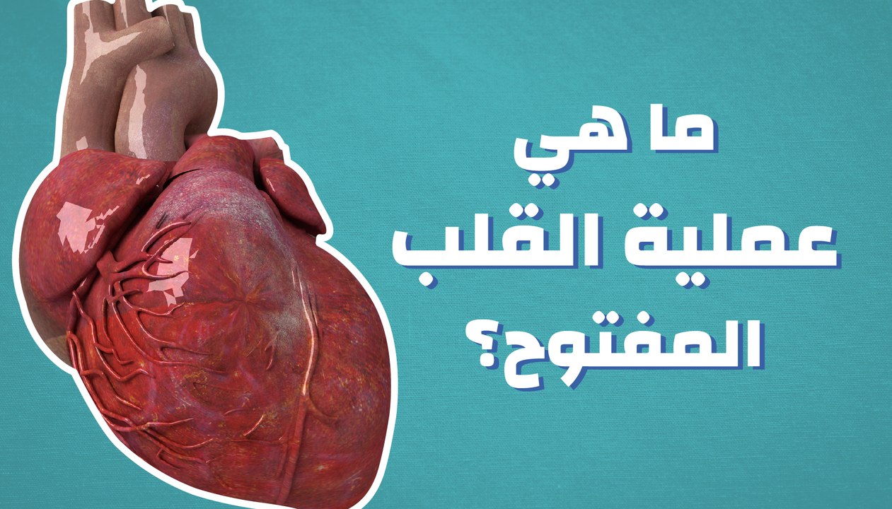 ما هي عملية القلب المفتوح؟