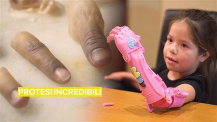 Quasi cyborg: le protesi hanno fatto passi da gigante