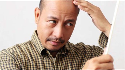 PRP Treatment, Terapi Plasma Darah yang Ampuh Atasi Kebotakan