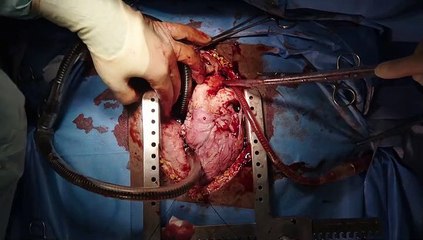 Holby City S21E27 Flying Solo