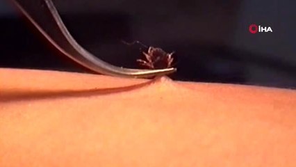 Çorum'da KKKA şüphesiyle 2 kadın tedavi altına alındı