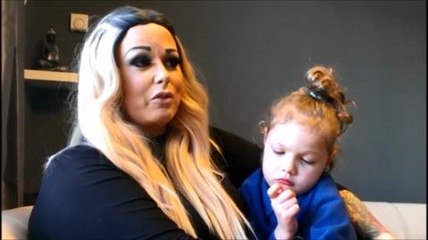 Girl with microcephaly