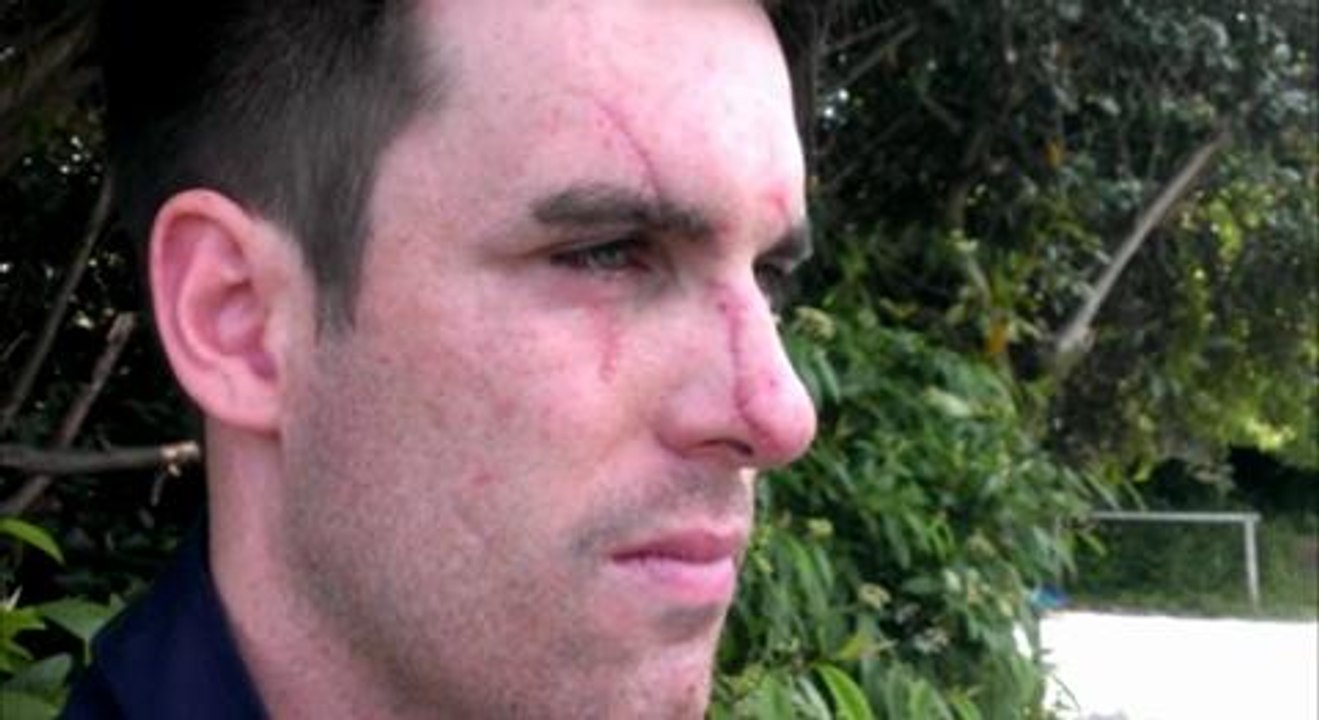 Nightclub attack