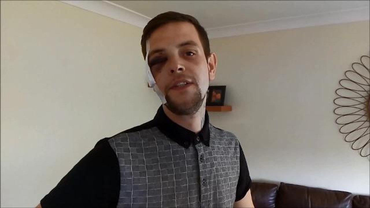 Josh Andrews talks about his attack